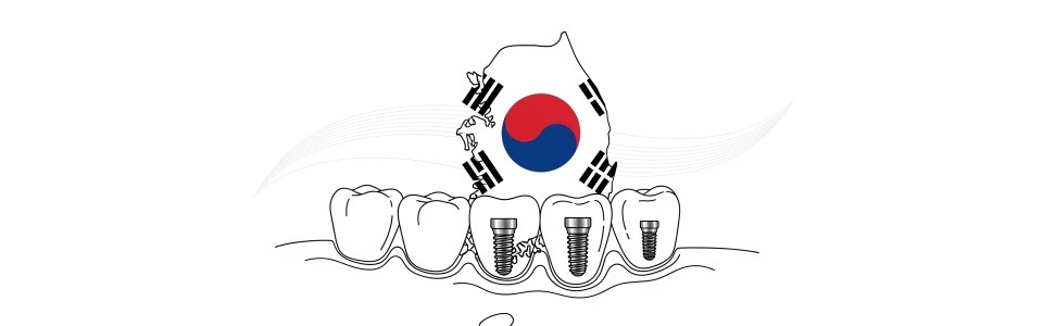 치아 임플란트 가격이 들쑥날쑥한 진짜 이유: ‘총비용’부터 보면 마음이 편해져요
